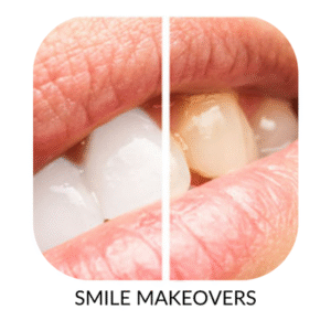 Best Dental Clinic in India